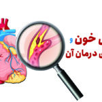 همه چیز درباره چربی خون و راه های درمان و علائم آن