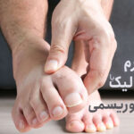 ارتباط سندروم متابولیک با هایپراوریسمی