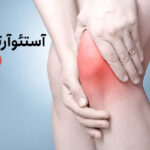 استئوآرتریت یا آرتروز چیست؟