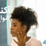 آکنه و انواع آن