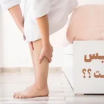 علت ابتلا به واریس، علائم و نشانه ها + راهکار درمان واریس