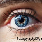 آب سیاه یا گلوکوم چیست؟+6 علامت بیماری آب سیاه