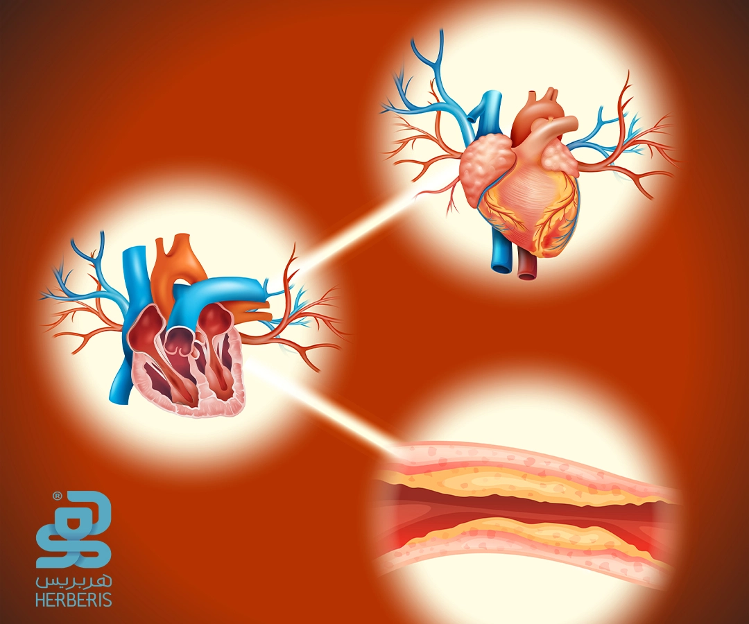 بیماری عروق قلب